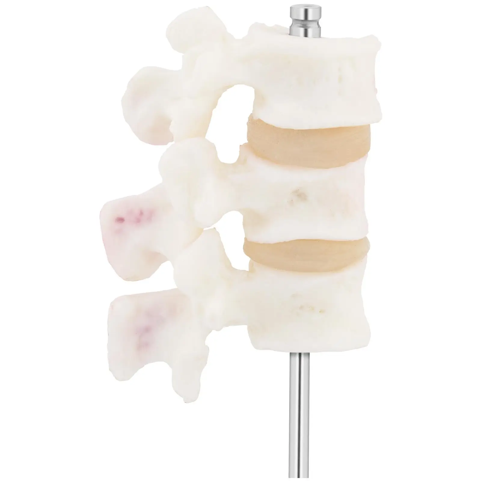 Osteoporoza lędźwiowa - model anatomiczny